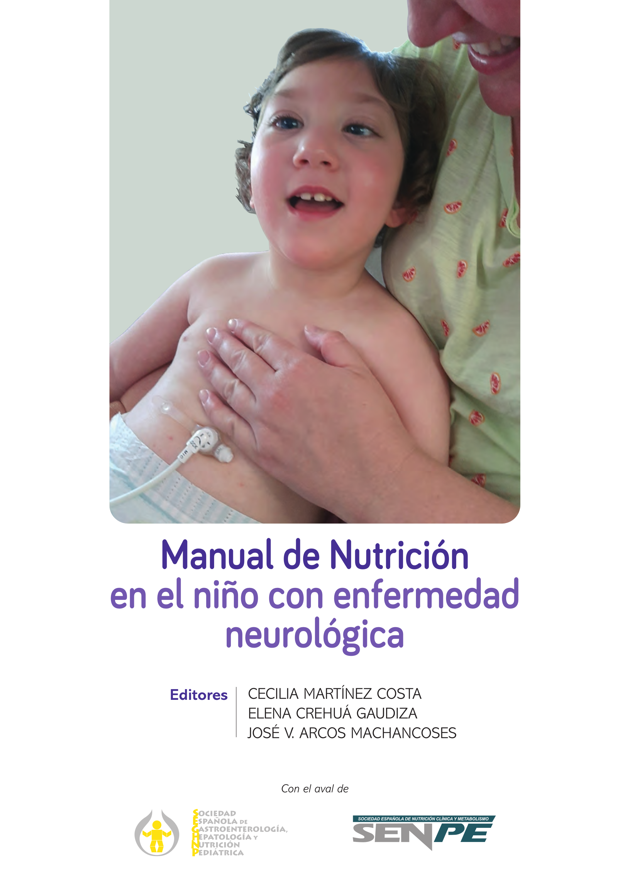 Manual de Nutrición en el niño con enfermedad neurológica