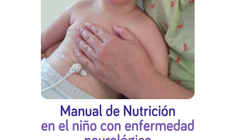 Manual de Nutrición en el niño con enfermedad neurológica